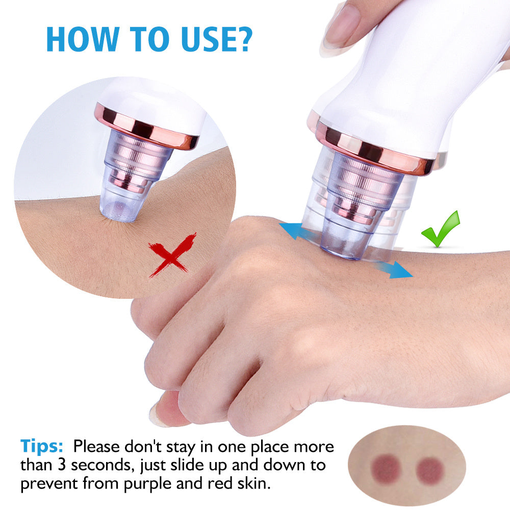 Electric Blackhead Suction Facial Washing Instrument